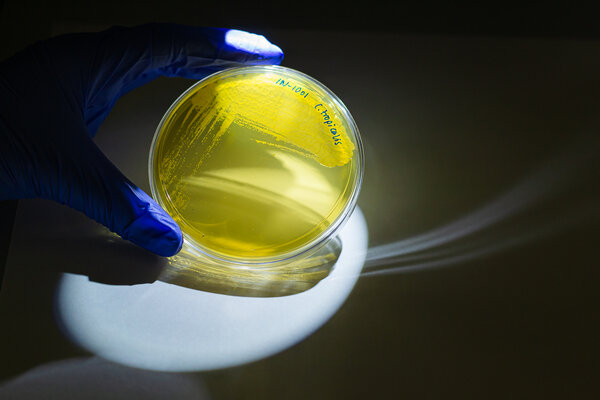 A close-up view of a yellow culture in a petri dish, held by a blue-gloved hand under a spotlight. The background is cached in shadow and written in marker on the petri dish are the words, &quot;C. tropicalis.&quot;
