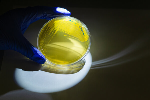 A close-up view of a yellow culture in a petri dish, held by a blue-gloved hand under a spotlight. The background is cached in shadow and written in marker on the petri dish are the words, "C. tropicalis."