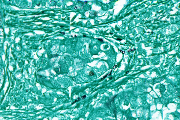 A swirl of cells in turquoise fill the frame. Some of the swirls are lined with small black blobs.